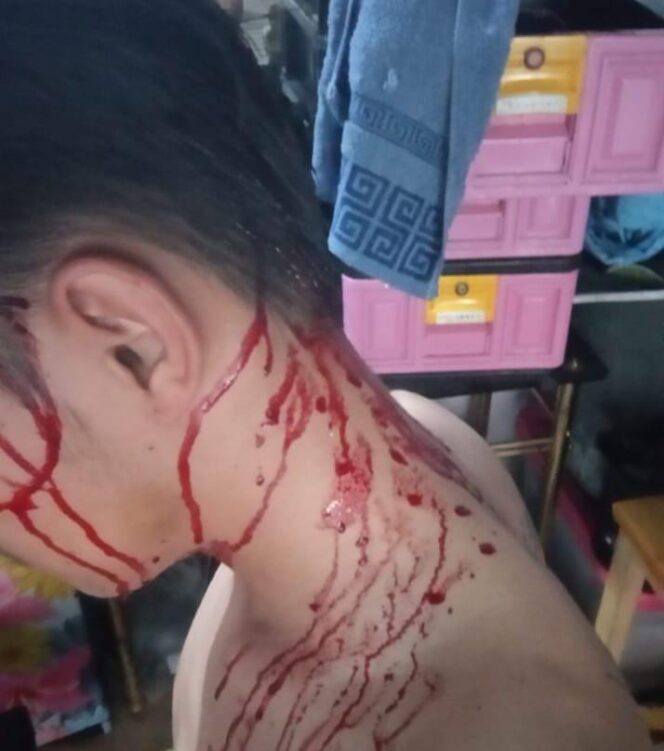 
					Pelaporan Kasus Penganiayaan Kembali Lagi Terjadi Di Wilayah Polsek Jonggol