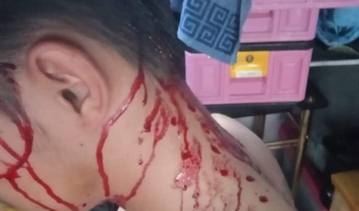 Pelaporan Kasus Penganiayaan Kembali Lagi Terjadi Di Wilayah Polsek Jonggol