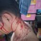 Pelaporan Kasus Penganiayaan Kembali Lagi Terjadi Di Wilayah Polsek Jonggol