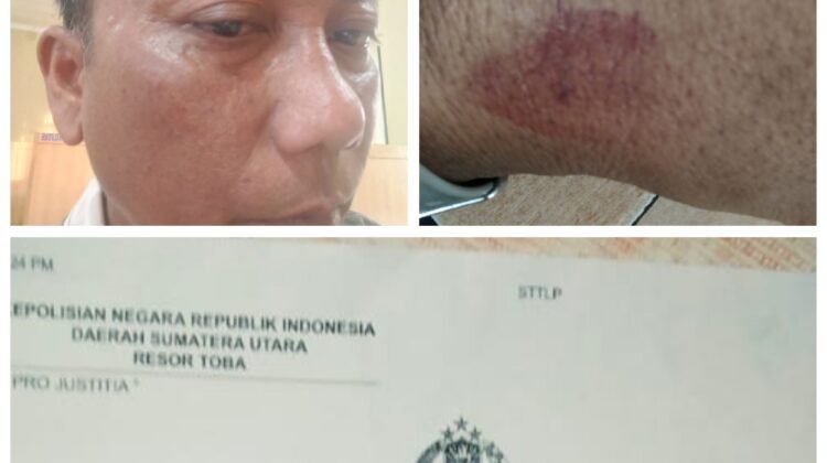 DPD PJS Sumut Desak Polisi Tangkap Pelaku Penganiayaan Wartawan di Toba