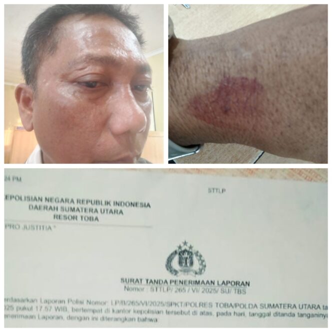
					DPD PJS Sumut Desak Polisi Tangkap Pelaku Penganiayaan Wartawan di Toba